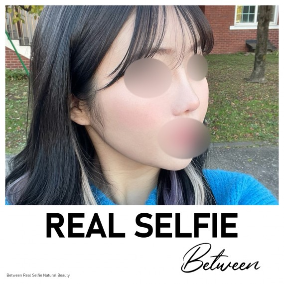 비…