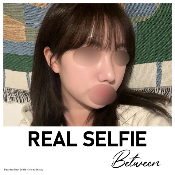 비…