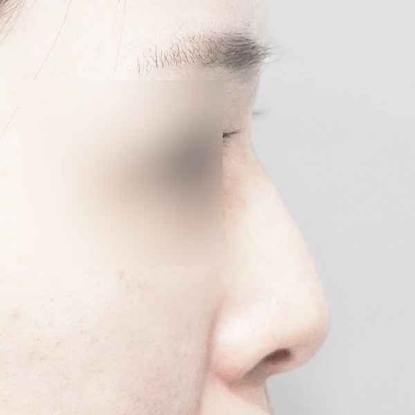 코…