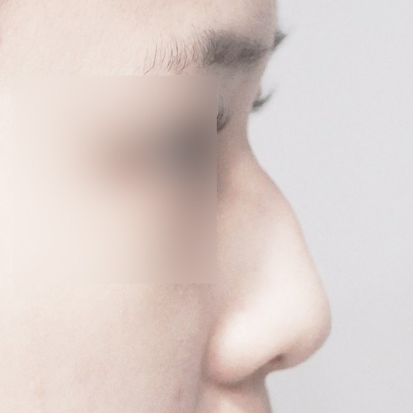 코…