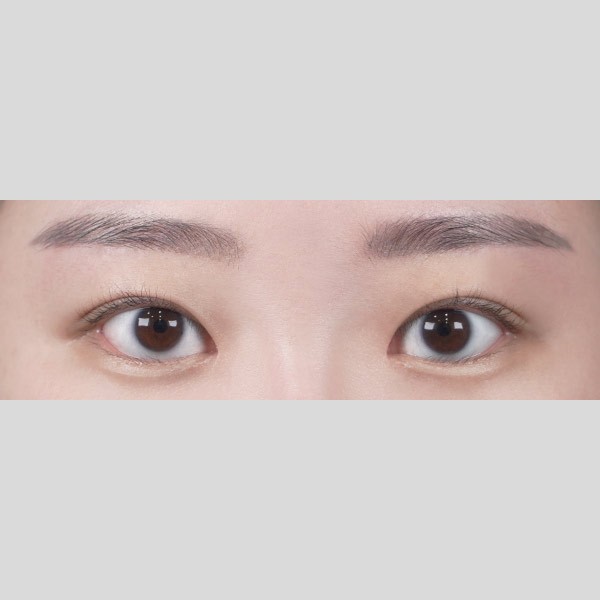 자연유착