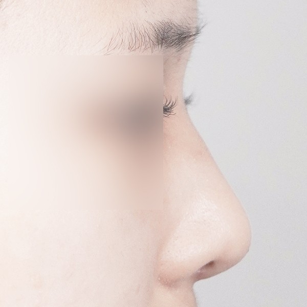 코…
