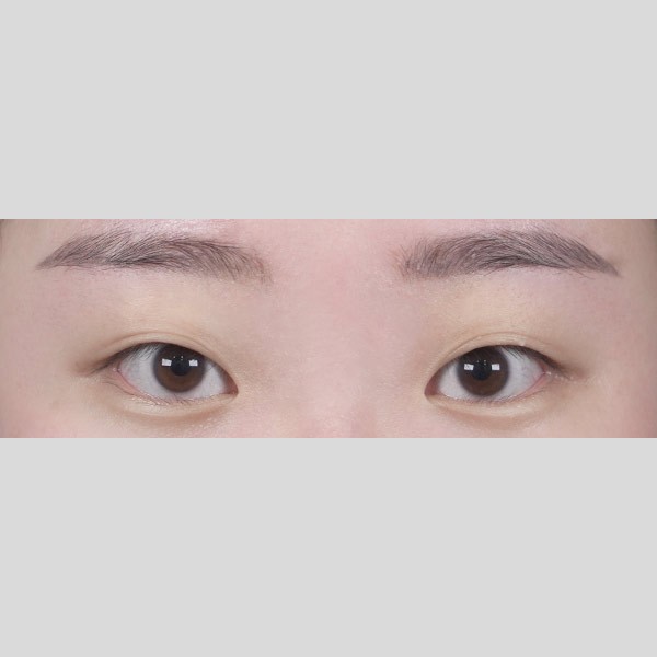 자연유착
