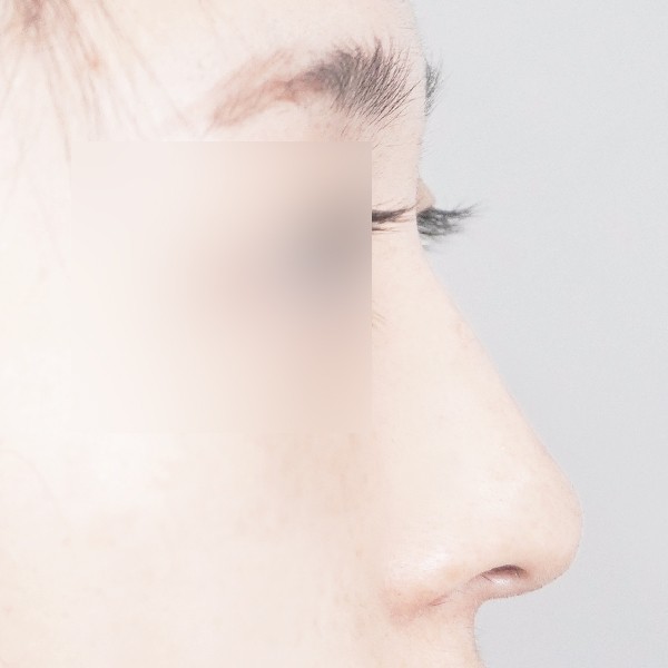 코…